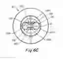 Fig. 07 - Actuator system for rotating valve pin