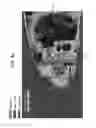 Fig. 05 - Aerodynamic device to optimize air flow through heat exchangers