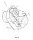 Fig. 02 - Bicycle handlebar cover