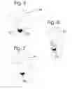 Fig. 04 - No spill cap assembly