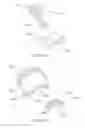 Fig. 13 - REFILLABLE SPRAY BOTTLE