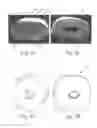 Fig. 02 - Compressed Hollow Coreless Re-Formable Roll Products