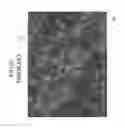 Fig. 21 - CNT metal composite material, and method for producing same