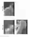 Fig. 23 - CNT metal composite material, and method for producing same