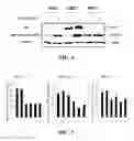 Fig. 05 - Compositions and methods for glucose transport inhibition