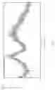 Fig. 08 - Crystalline form of (S)-N-(5-((R)-2-(2,5-difluorophenyl)-pyrrolidin-1-yl)-pyrazolo[1,5-A]pyrimidin-3-yl)-3-hydroxypyrrolidine-1-carboxamide hydrogen sulfate