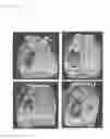 Fig. 08 - Peptide and Complex of Same, Scaffold for Tissue Repair and Surface Treatment Method for Same, and Surface Treatment Solution or Set of Treatment Solutions