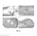 Fig. 31 - GLUCAGON-LIKE PEPTIDE-2 COMPOSITIONS AND METHODS OF MAKING AND USING SAME