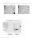 Fig. 09 - Method for refining protein including self-cutting cassette and use thereof