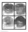 Fig. 02 - ANTIBODY FORMULATIONS