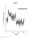 Fig. 08 - Antibody specifically binding to insulin-like growth factor-1