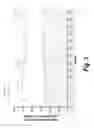 Fig. 05 - METHODS FOR TREATING HIGH CARDIOVASCULAR RISK PATIENTS WITH HYPERCHOLESTEROLEMIA