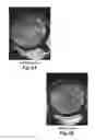 Fig. 04 - PACKAGING FORMULATION FOR PREVENTING THE INSOLUBILITY OF CHITOSAN-CONTAINING COMPOSITIONS