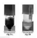 Fig. 06 - PACKAGING FORMULATION FOR PREVENTING THE INSOLUBILITY OF CHITOSAN-CONTAINING COMPOSITIONS