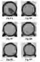 Fig. 10 - PACKAGING FORMULATION FOR PREVENTING THE INSOLUBILITY OF CHITOSAN-CONTAINING COMPOSITIONS