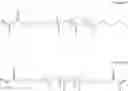 Fig. 70 - Particles for electrophoretic displays