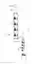 Fig. 08 - CLOSED-CELL EXPANDED ARTICLE BASED ON EXTRUDED POLYSTYRENE, METHOD AND PLANT TO OBTAIN SAID ARTICLE