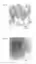 Fig. 06 - Polyarylene sulfide resin composition and method for producing same