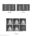 Fig. 05 - A Microfluidic Device with a Diffusion Barrier