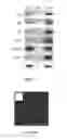 Fig. 04 - METHODS AND COMPOSITIONS FOR PRODUCING GERM CELLS FROM BONE MARROW DERIVED GERMLINE STEM CELLS