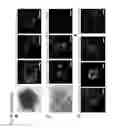 Fig. 11 - Method for producing renal progenitor cells