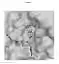 Fig. 04 - CRYSTAL STRUCTURE OF BLOOD COAGULATION FACTOR XIIIA