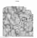 Fig. 05 - CRYSTAL STRUCTURE OF BLOOD COAGULATION FACTOR XIIIA