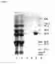 Fig. 03 - Method for purifying active GLA-domain coagulation proteins