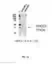 Fig. 16 - Amino acid sequence presenting fusion polypeptide and its use