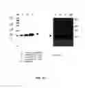 Fig. 33 - Amino acid sequence presenting fusion polypeptide and its use
