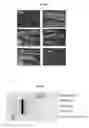 Fig. 07 - Agrobacterium-mediated transformation of lipomyces