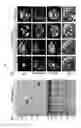 Fig. 07 - Method for inactivating target transcription factor using artificial small interfering peptide and use thereof