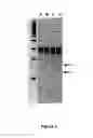 Fig. 02 - IMPROVED POLYNUCLEOTIDE SEQUENCES ENCODING TALE REPEATS