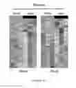 Fig. 05 - METHODS AND COMPOSITIONS FOR THE DIAGNOSIS, PROGNOSIS AND TREATMENT OF BRAIN METASTASIS