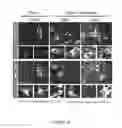 Fig. 11 - METHODS AND COMPOSITIONS FOR THE DIAGNOSIS, PROGNOSIS AND TREATMENT OF BRAIN METASTASIS