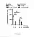 Fig. 21 - METHODS AND COMPOSITIONS FOR THE DIAGNOSIS, PROGNOSIS AND TREATMENT OF BRAIN METASTASIS