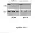 Fig. 23 - METHODS AND COMPOSITIONS FOR THE DIAGNOSIS, PROGNOSIS AND TREATMENT OF BRAIN METASTASIS