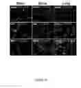 Fig. 25 - METHODS AND COMPOSITIONS FOR THE DIAGNOSIS, PROGNOSIS AND TREATMENT OF BRAIN METASTASIS