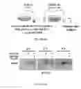 Fig. 26 - METHODS AND COMPOSITIONS FOR THE DIAGNOSIS, PROGNOSIS AND TREATMENT OF BRAIN METASTASIS