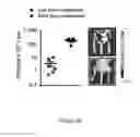 Fig. 32 - METHODS AND COMPOSITIONS FOR THE DIAGNOSIS, PROGNOSIS AND TREATMENT OF BRAIN METASTASIS