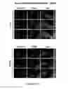Fig. 41 - METHODS AND COMPOSITIONS FOR THE DIAGNOSIS, PROGNOSIS AND TREATMENT OF BRAIN METASTASIS