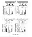 Fig. 47 - METHODS AND COMPOSITIONS FOR THE DIAGNOSIS, PROGNOSIS AND TREATMENT OF BRAIN METASTASIS
