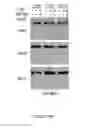 Fig. 76 - METHODS AND COMPOSITIONS FOR THE DIAGNOSIS, PROGNOSIS AND TREATMENT OF BRAIN METASTASIS