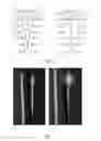 Fig. 05 - METHOD OF MANUFACTURING A METAL MATRIX COMPOSITE COMPONENT BY USE OF A REINFORCEMENT PREFORM