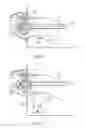 Fig. 05 - Marine cathodic protection system