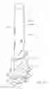 Fig. 11 - Traffic control marker including a reinforced retaining member