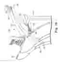 Fig. 18 - Rotor and rotor housing for a snowthrower