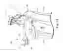 Fig. 19 - Rotor and rotor housing for a snowthrower