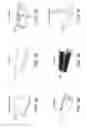 Fig. 10 - System for Improving Safety in Use of a Machine of a Kind Comprising a Body and an Implement Movable Relative to the Body