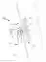 Fig. 26 - JAMB INSTALLATION DEVICE AND METHOD